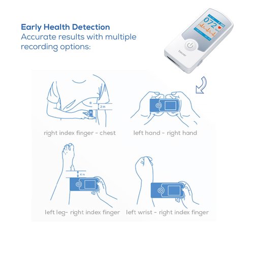 Beurer Cardio Companion EKG Monitor - 3-Lead Portable ECG Machine, Detects Irregular Heart Rhythms, Fast Results in 30 Seconds, Bluetooth with App, Rechargeable Battery, FSA/HSA Eligible, ME75