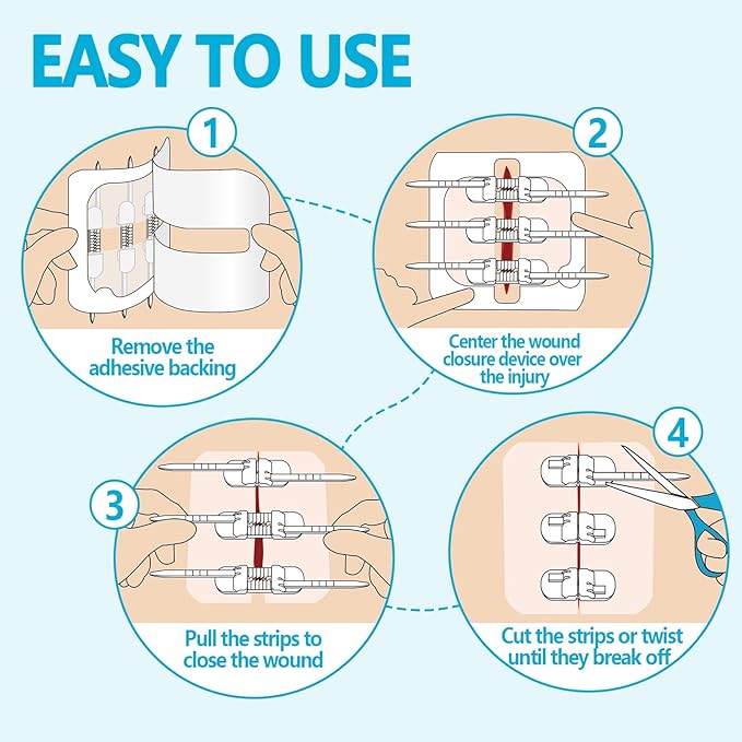 Senvok Butterfly Bandaids with Zip Stitch – 2 Pcs FSA/HSA Eligible Large Wound Closure Strips for Big Wound Care, Quick Clot Emergency Repair, Hospital-Grade Skin Closure for Home & Outdoor Use